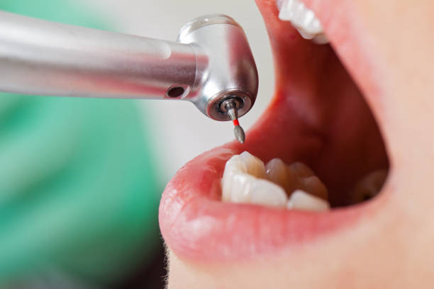 Best Emergency Denture Repair in Tri City, OR